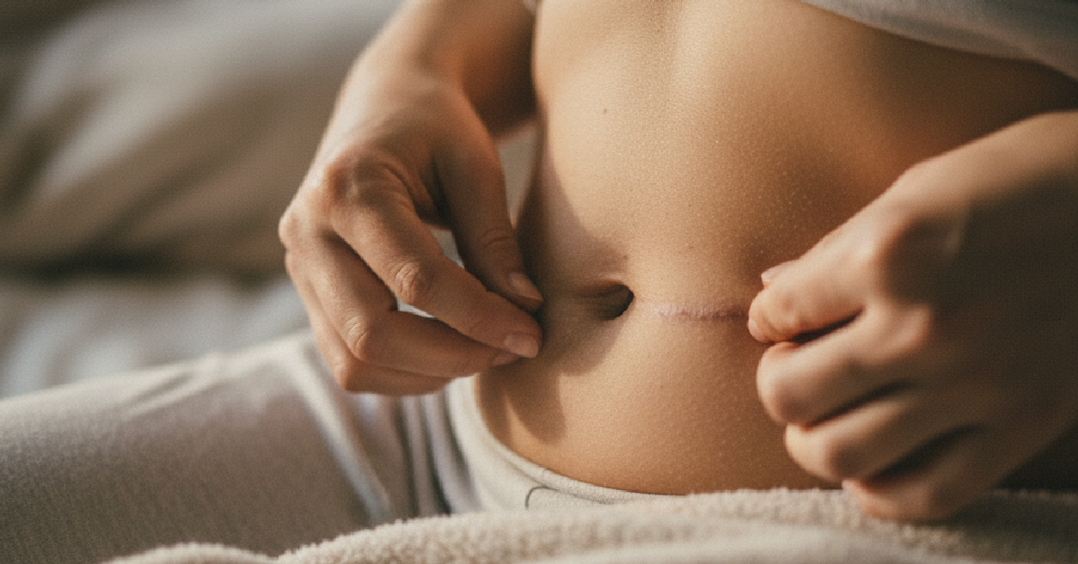 Ilustração do artigo