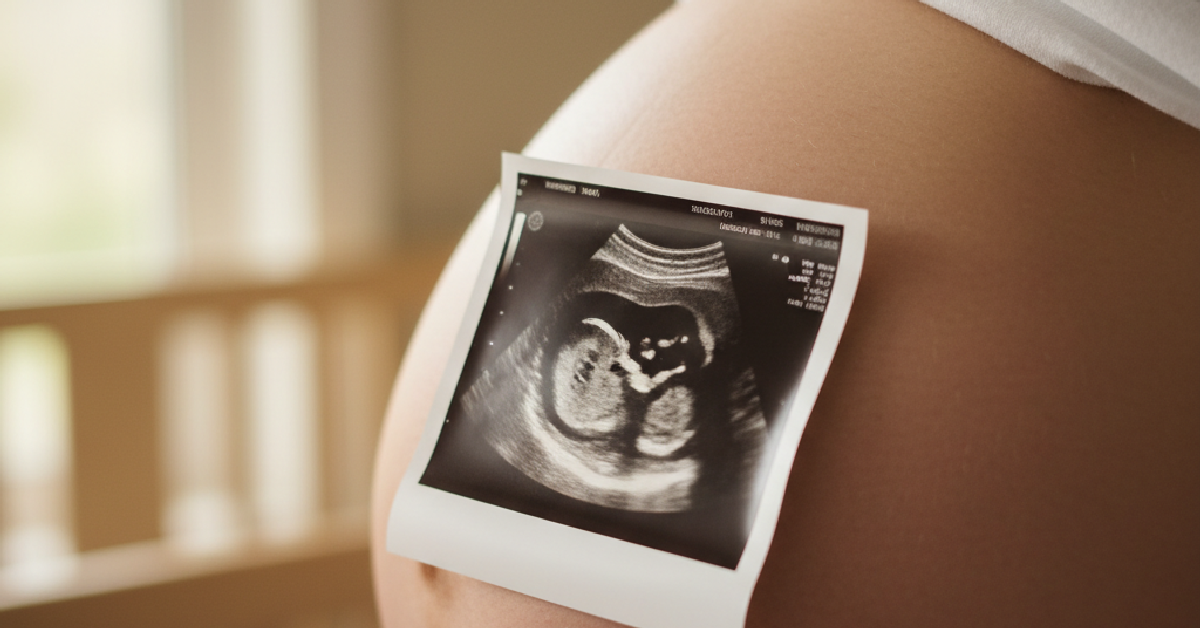 Ilustração do artigo